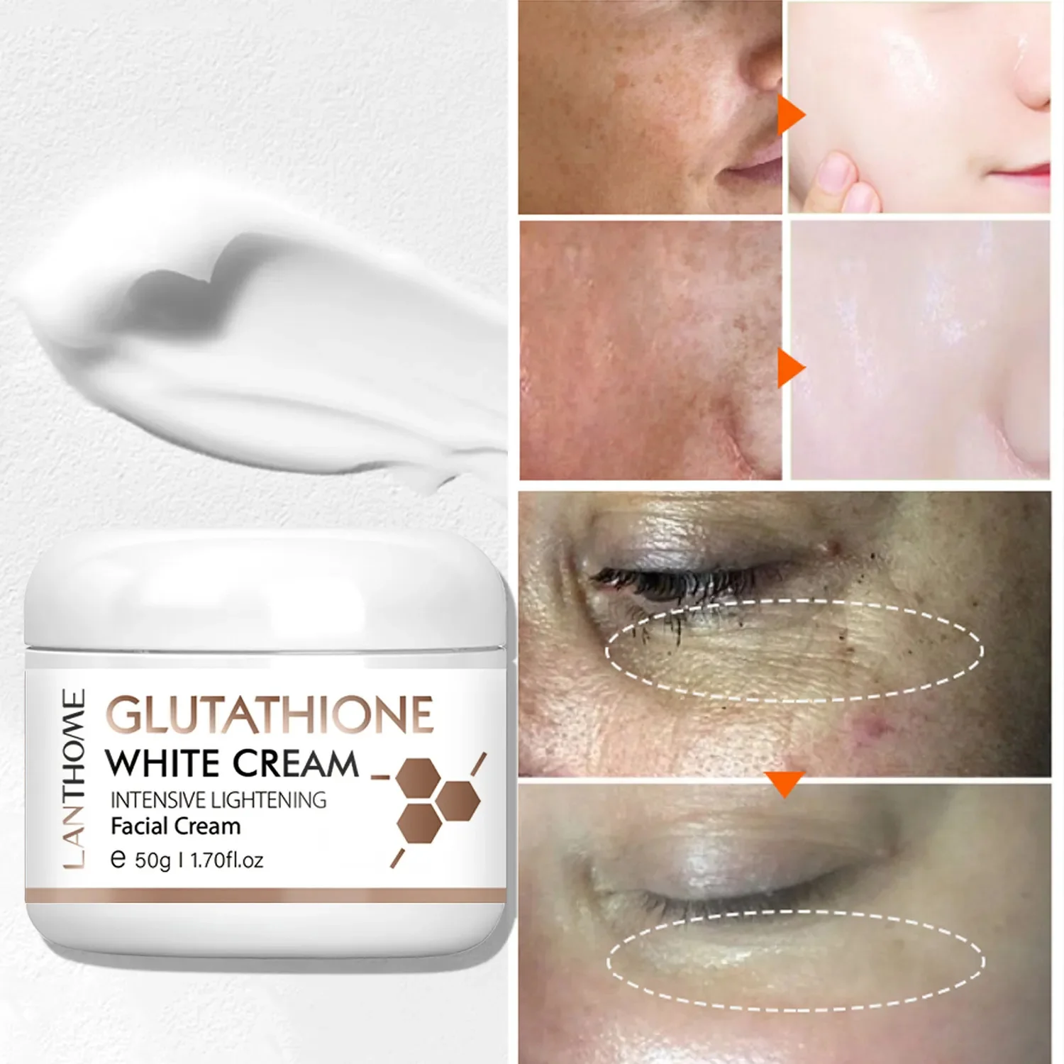 Glutathione Whitening Freckle Face Cream Remove Dark Spots Lighten Melasma Melanin Fade Acne Scars Anti-Aging_voghion.com