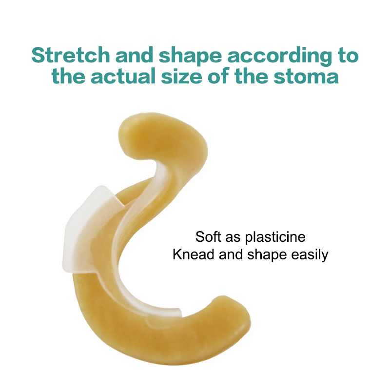 Anti-Leakage Ring For Colostomy Bag Ostomy Paste Ring Base Plates Stoma Care Products To Protect Skin