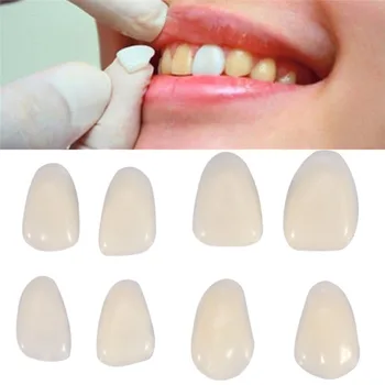 Faccette Dentali Sottilissime in Resina per Sbiancamento, Denti Superiori Anteriori, Faccette Dentali Temporanee