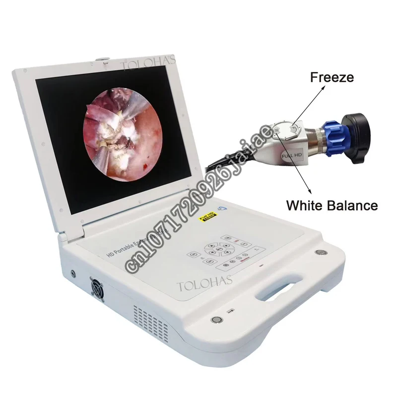 

LHGW612 Portable HD Quality Endoscopy Unit System Medical ENT Endoscope