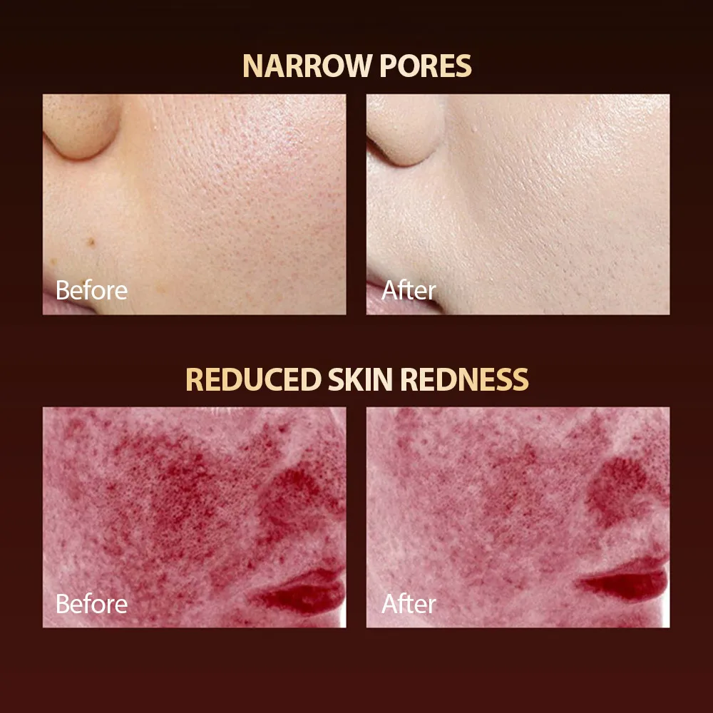 7 Colors LED Face Mask Silicone Gel Red Light Therapy Photon Silicone Facial Mask for Oil Control Repair Tightening Pigmentation