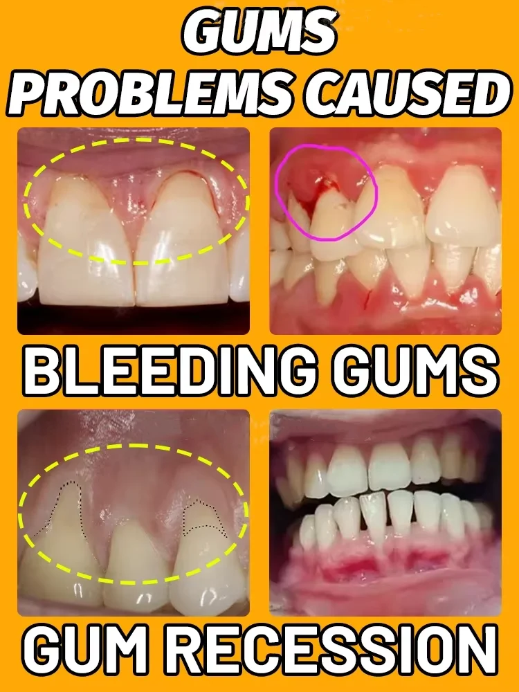 Rapid Repair Gums Serum Effectively Relieve Tooth Allergy Dental Caries Tooth Cleaning Toothpaste Relieve Damage Drops gum repair drops teeth health product