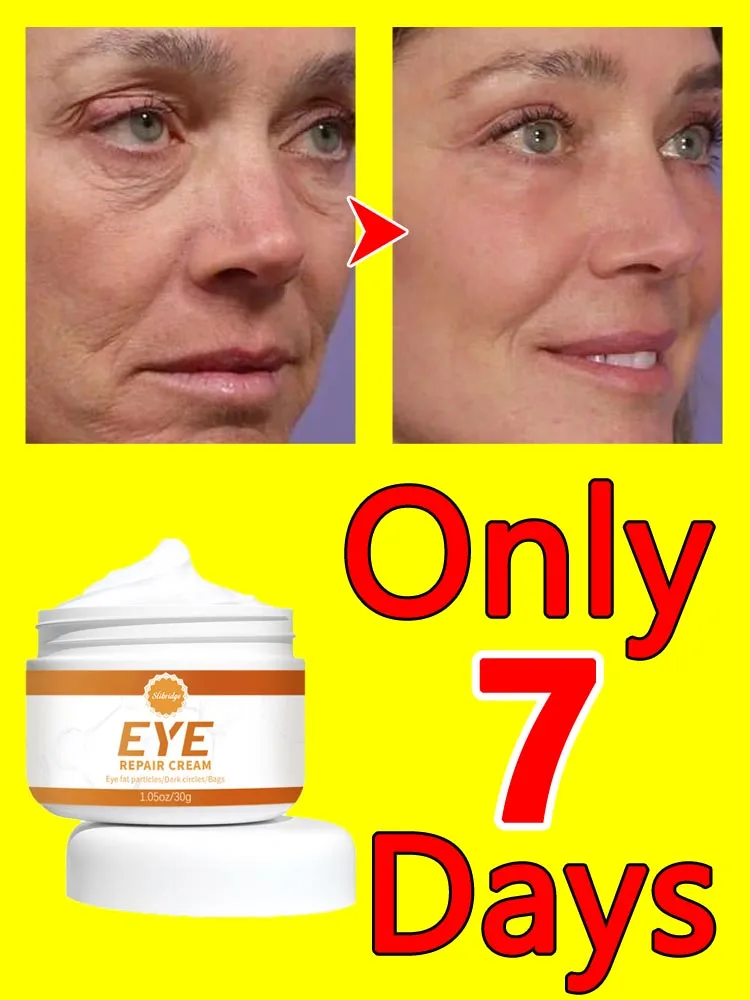 

Eye Bags Cream Improve Eyes Wrinkle
