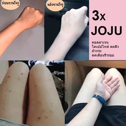 3X JOJU Collagen Dipeptide Reduce Acne Dark Spots Freckles oil control Smooth Lightening Whiten and brighten Younger Skin Care