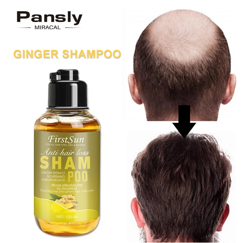 Genuine Professional Hair Ginger Shampoo Hair Regrowth Fast Thicker Repair Hair RootHair Growth Shampoo Anti Hair Loss Product genuine hot wheels premium car fast