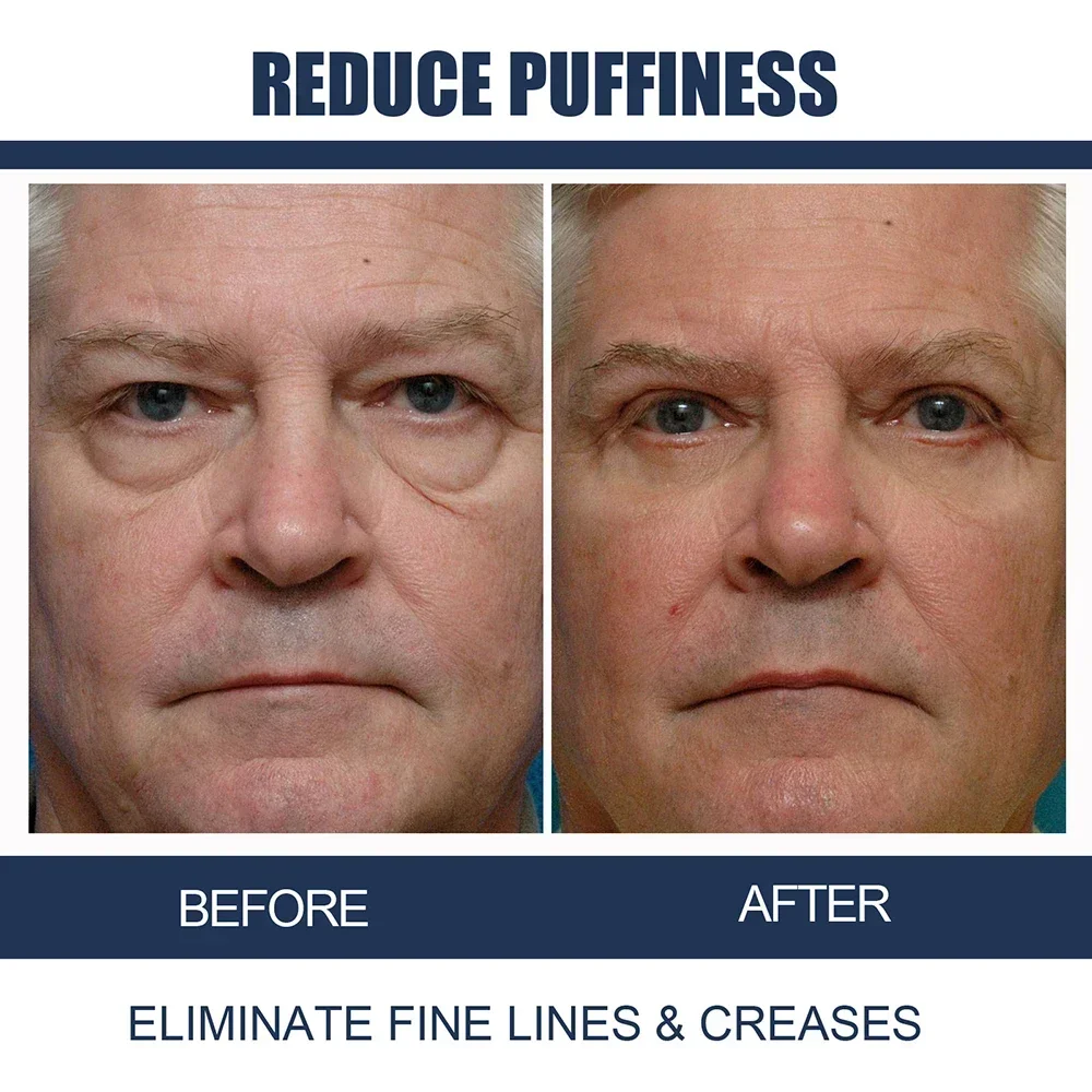 Men Retinol Anti Wrinkle Eye Cream Anti Dark Circles Remove Eye Bags Fade Fine Line Lifting Firming Moisturizer Repair Care