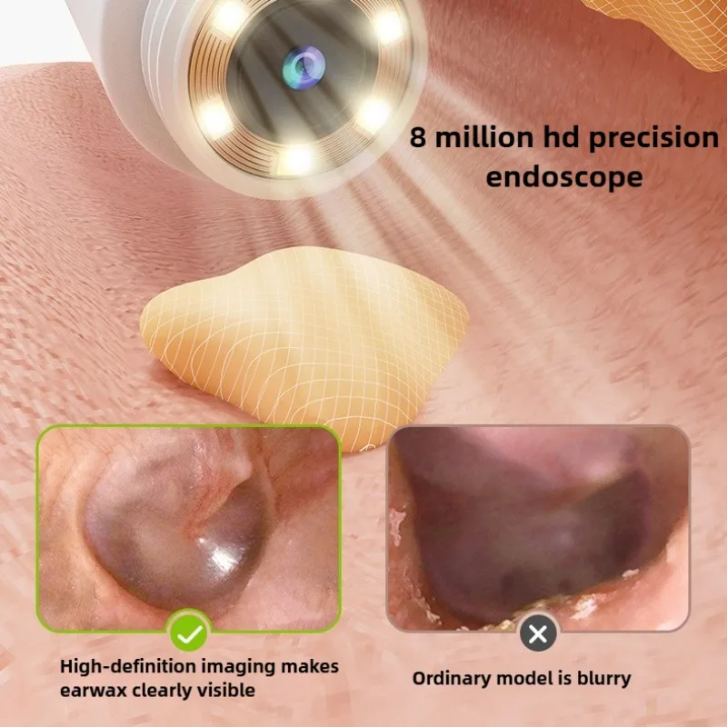 Visual Ear Cleaner with Camera Wax Removal Tool with Ear Pick & Tweezers 12 Megapixels 6 Ear Spoons Earwax Removal Tool