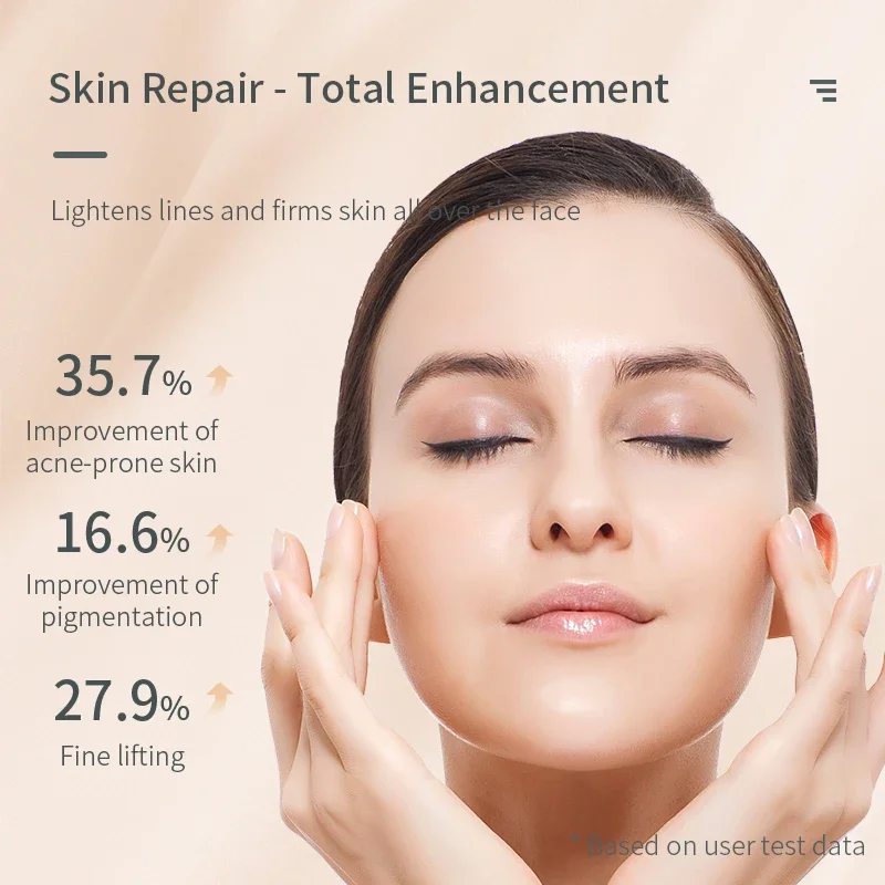 Ozone Plasma Pen Scar Acne Removal Wand Anti Wrinkle Aging Therapy Acne Pen Beauty and Skincare Device Facial Skin Care Machine