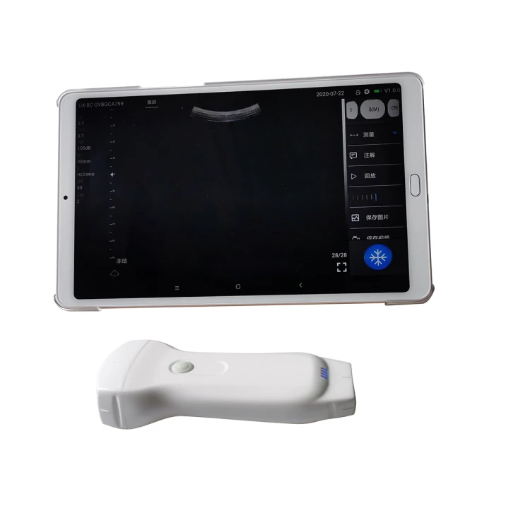 

2021 Popular Highest Cost-effective Double Probes Wireless Color Doppler Ultrasound Scanner MSLPU80