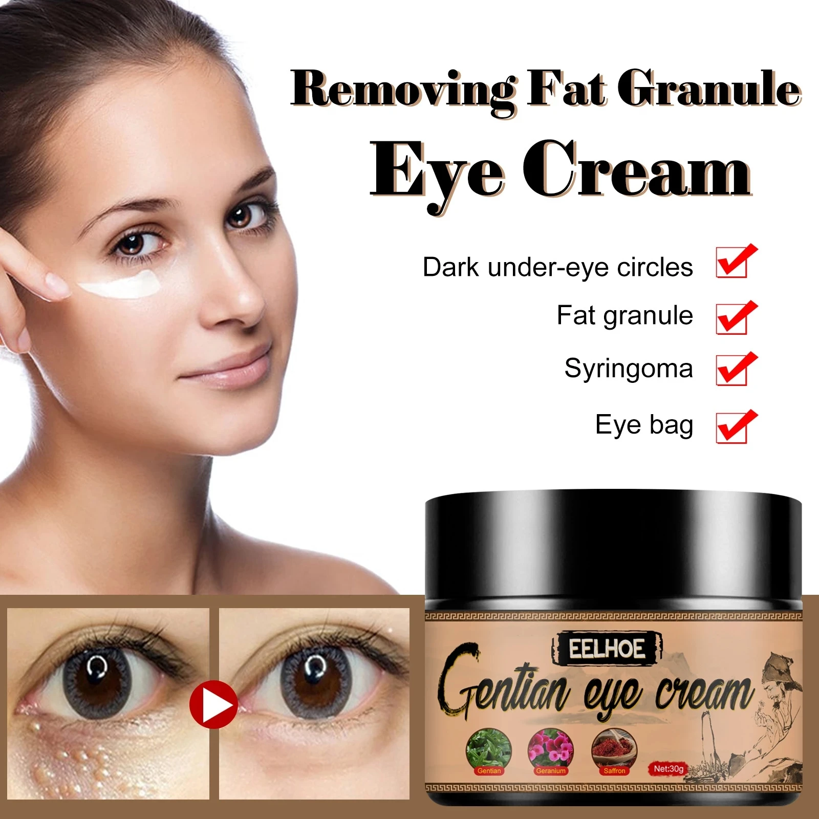 Eyes Cream Effective Removes Fat Granules Improve Eye Bag Fine Lines