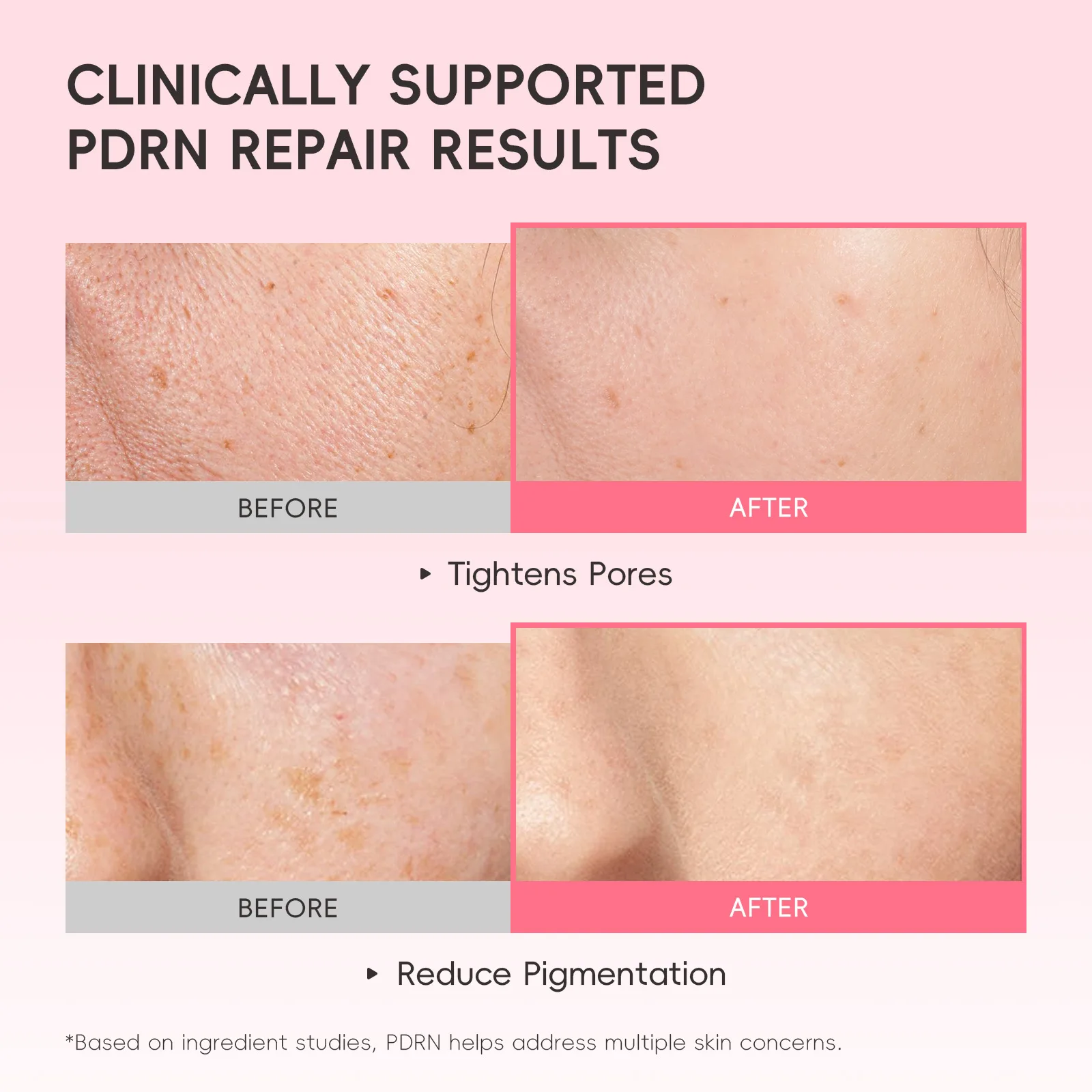 LAIKOU Centella Asiatica Ampoule Facial Serum Moisturizing Brightening for Face Care Hydrating Skincare