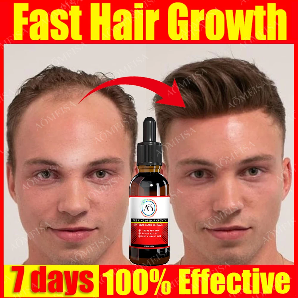 Huile anti chute de cheveux séborrhéique, croissance rapide des cheveux