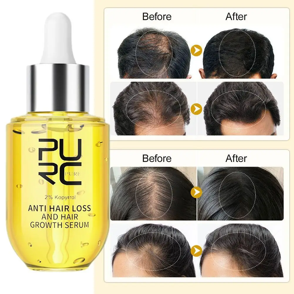 

Ginger Anti Hair Loss Scalp Treatment Grow Serum Products Hair Care For Men Women Fast Growth Hair Serums Oil Beauty Health