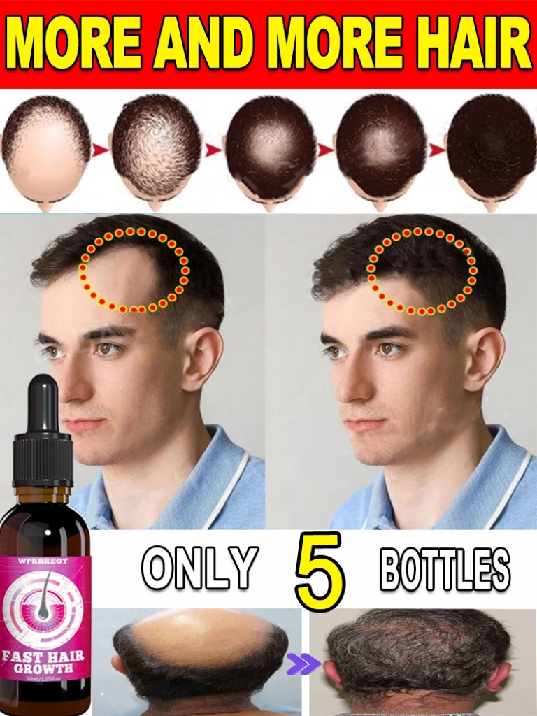 Hair Growth Oil Have More Hair Say Goodbye To Baldness