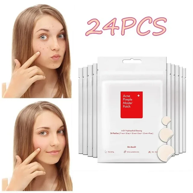 24pcs Face Acne Pimple Spot Facial Skin Care Blackhead Removal Freckle Patches Scar Care Treatment Stickers Acne Mask Beauty 1