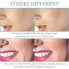4 In 1 Handheld Electric For Face Skin Beauty Tools Portable High Frequency Facial Therapy Wand Acne Treatment Machine Neon Wand 6
