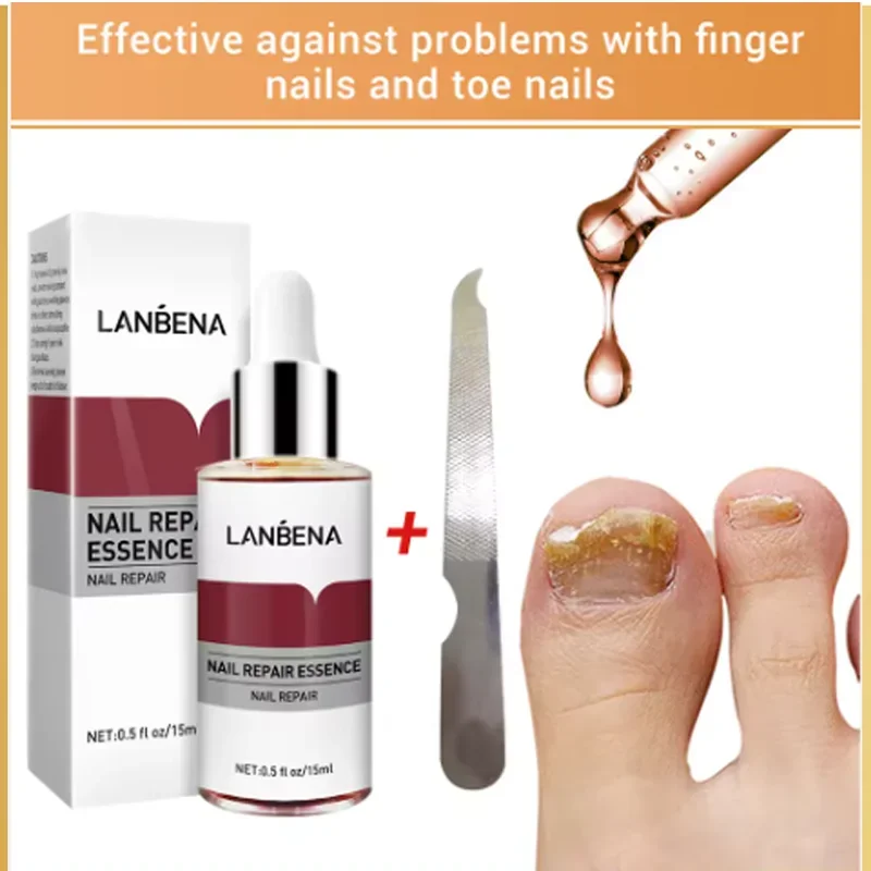 15mlFungus Care Remove Onychomycosis Toes Nourish Brighten Hands Feet Product Repair Suitable Women Nail Pepair Essencs