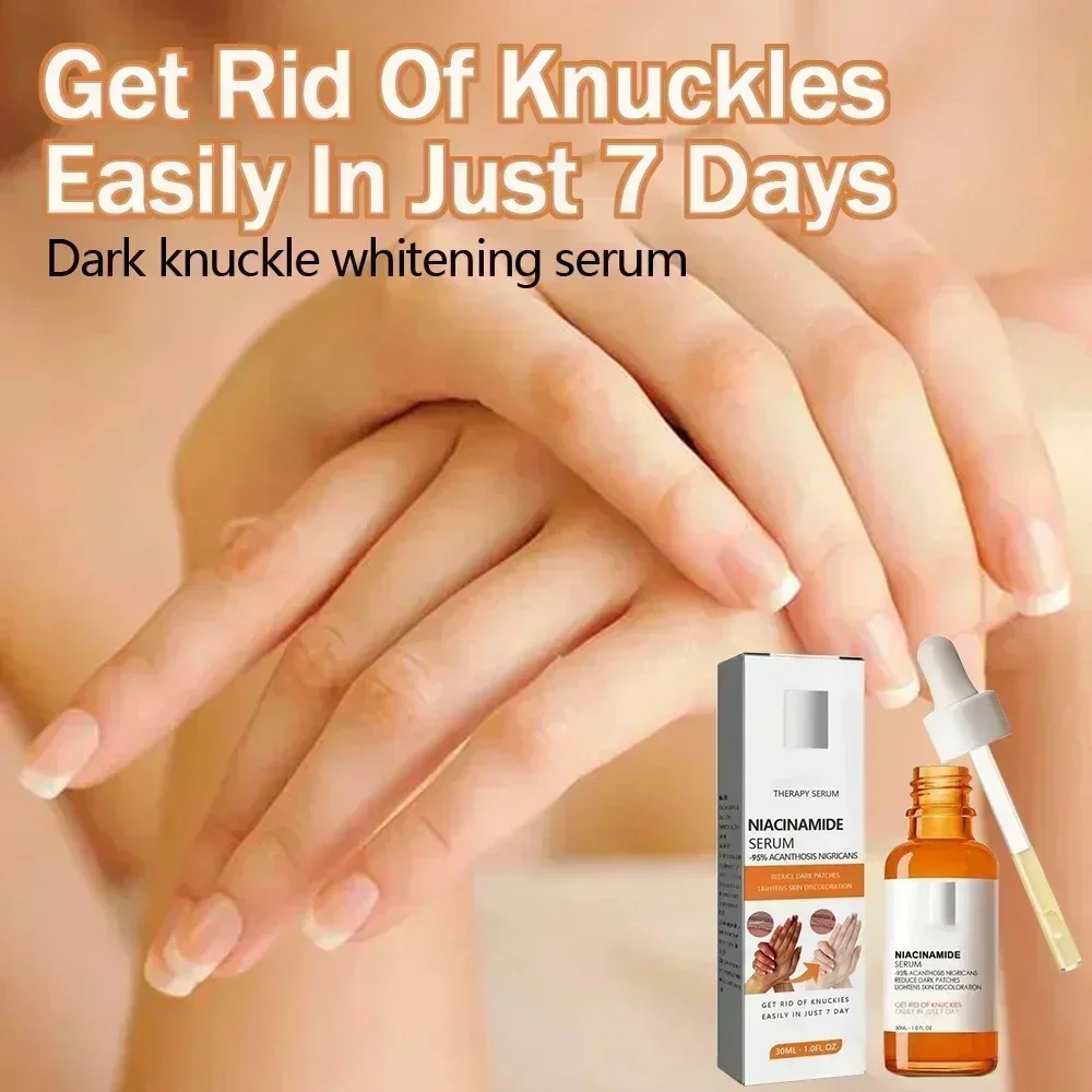 Dark knuckles whitening serum Elbows Armpit Beaching SerumWoman Private Part Skin Removal Dark Knuckles Strong Whitening Serum 3