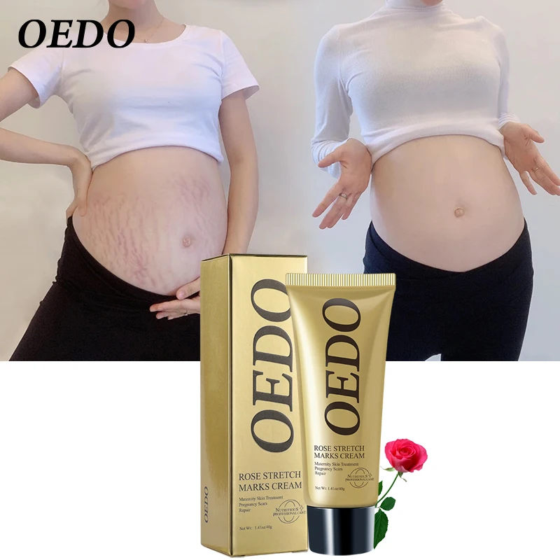 

OEDO Rose Remove Stretch Marks Cream Repair Stretch Marks Scars Restore Skin Elasticity Skin Care Promotes Cell Regeneration