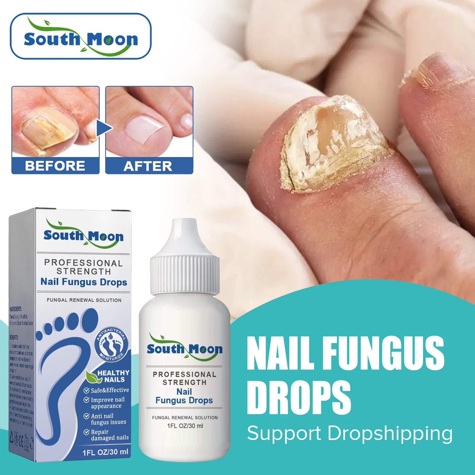 AntiFungalDropsAntiInfectionParonychiaOnychomycosisHandFoot