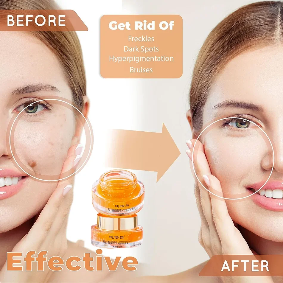 30ml Carrot Vitamin C Cream Whitening and Brightening Inhibiting Melanin Anti-aging Acne-removing Facial Skin Care Products