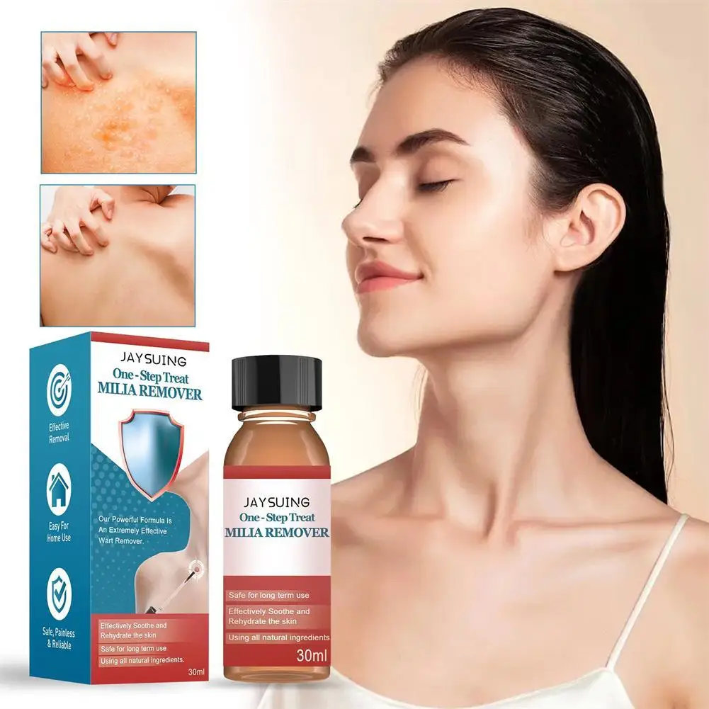 Milia Remover Essential 30ml Dark Circle Serum For Eyes Dark Eye Circle