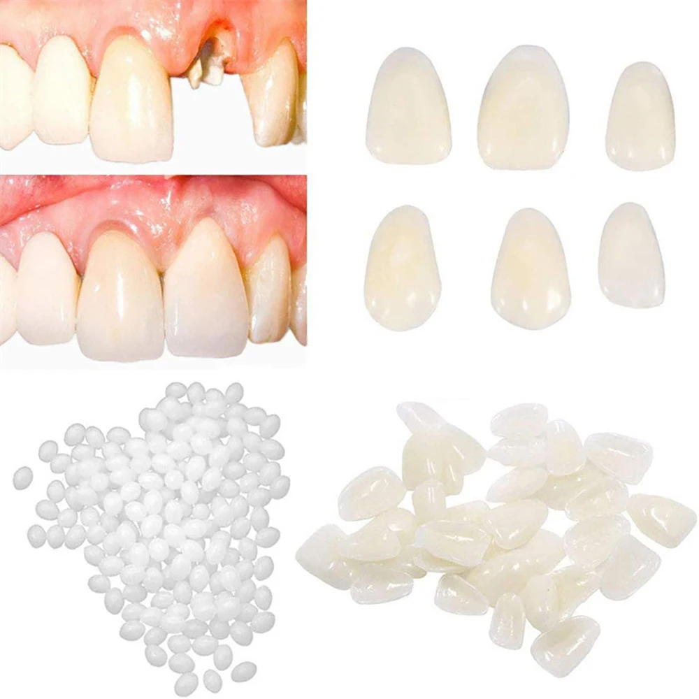 60Pcs/Box Dental Resin Molar Anterior Temporary Crown Porcelain Teeth Caps  Cover