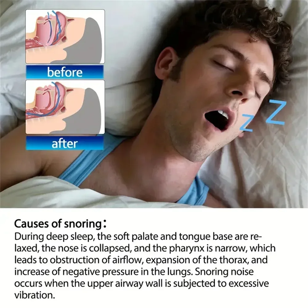 50–200pcs Anti-Snoring Nose Strips 6