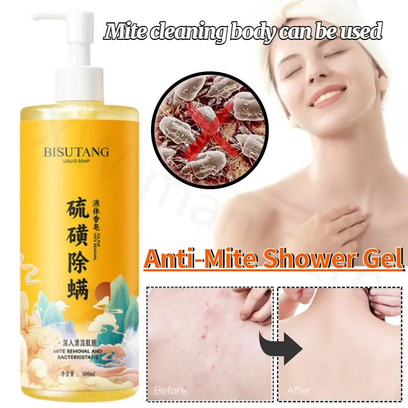 

Clean Mite Antibacterial Net Muscle Moisturizing Sulfur Mite Removal Shampoo Shower Gel Whole Body Care Anti-dandruff Itching