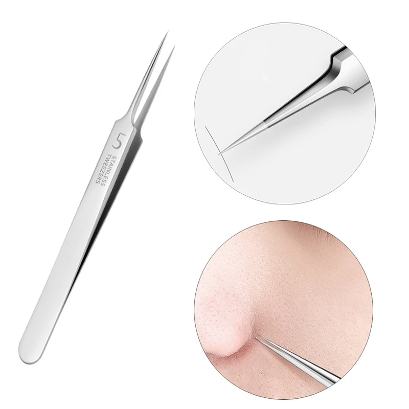 New Ultra-fine No. 5 Cell Pimples Blackhead Clip Tweezers Beauty Salon Special Scraping & Closing Artifact Acne Needle Tool tungsten needle sharpener tungsten electrode grinder ultra wide angle double wheel shaft tungsten electrode grinder special purp