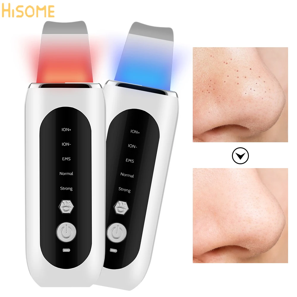 EMS Ultrasonic Skin Scrubber Face Spatula Facial Skin Exfoliator Scraper and Blackhead Remover Pore Cleaner Deep Cleansing