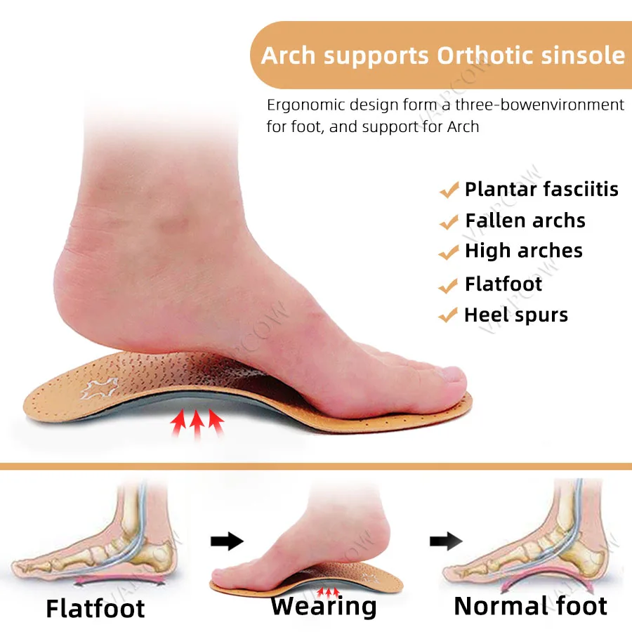 flat feet arch support