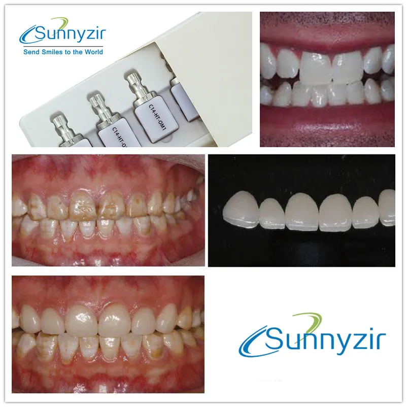 sunnyzir-emax-cerec-cad-lithium-disilicate-glass-ceramic-blocks-in-dental-lab-cerec-cad-cam-blocks-vita16-shades-available