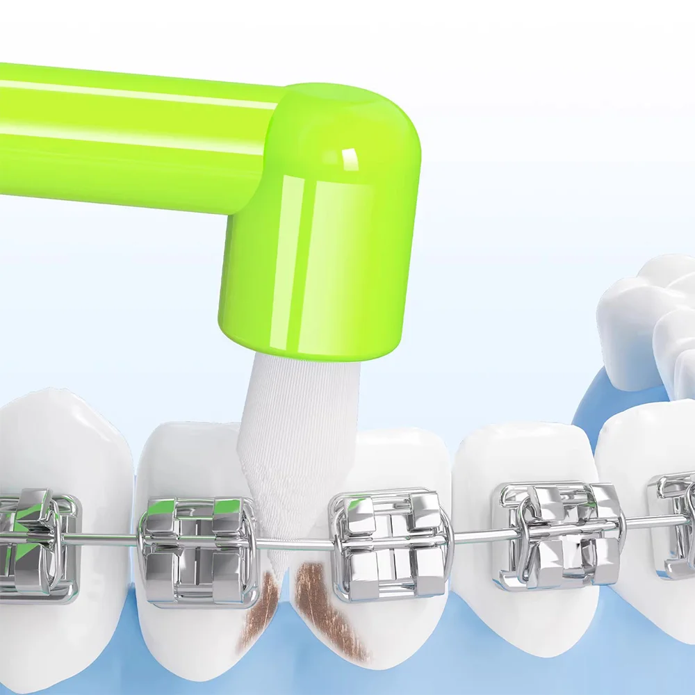 Precision Orthodontic Toothbrush for Enhanced Cleaning of Wisdom Teeth and Interdental Spaces