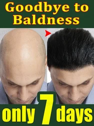 Hair growth oil,effective baldness repair, hereditary hair loss, postpartum hair loss