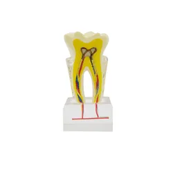 PNT OR12 dentes ampliados modelo transparente toot anatômico modelo dental demonstração presente médico equipamento educacional
