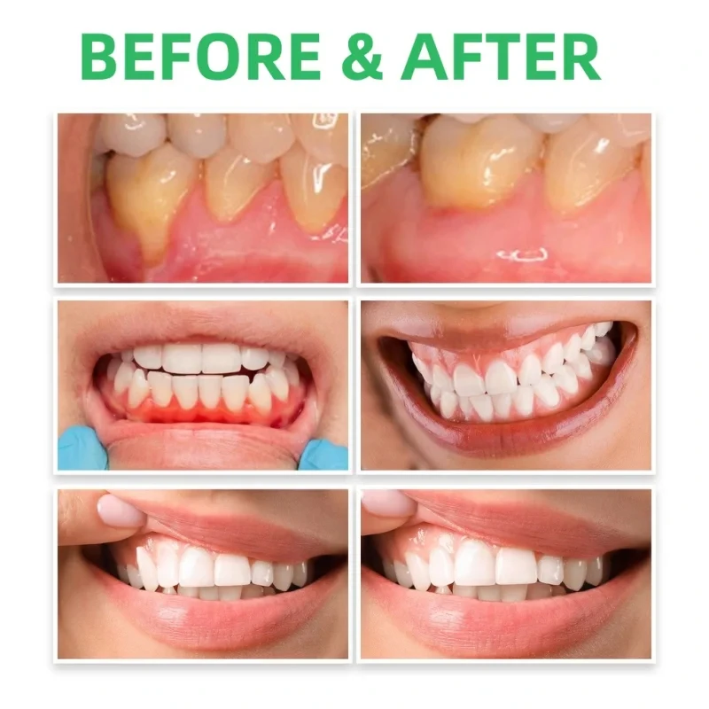 Gum Repair Drops Relieve Receding Gingival Swelling Gum Cleaning Care Oral Hygiene Remove Stain