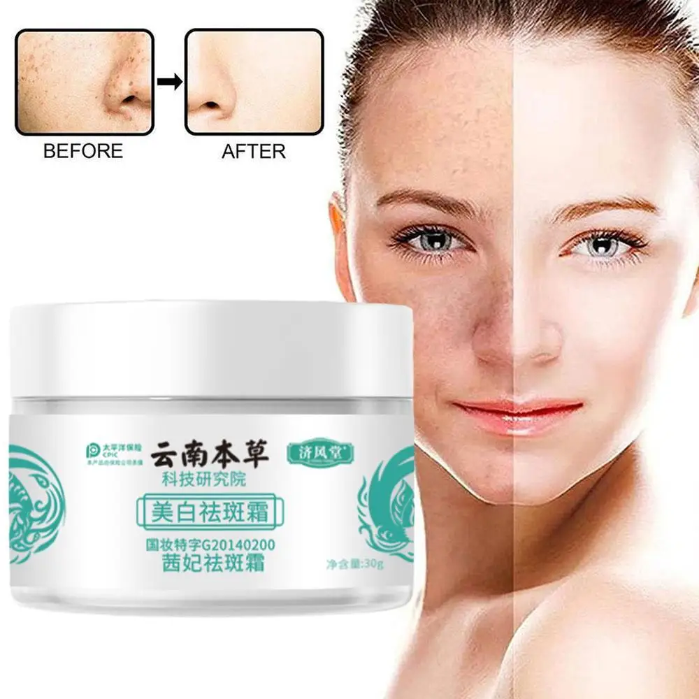 

30g Whitening Freckle Cream Lightens Freckles Melasma Brightening Skin Tone Firming Skin Anti-aging Skin Care Products Girl