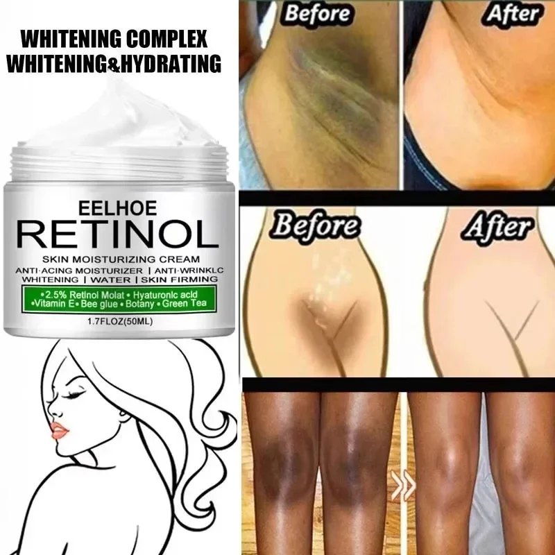 Body Whitening Cream Dark Skin Armpit Lightening Intimate Areas Underarm Bleaching Private Parts Whiten Cream Body Lotion Beauty 3