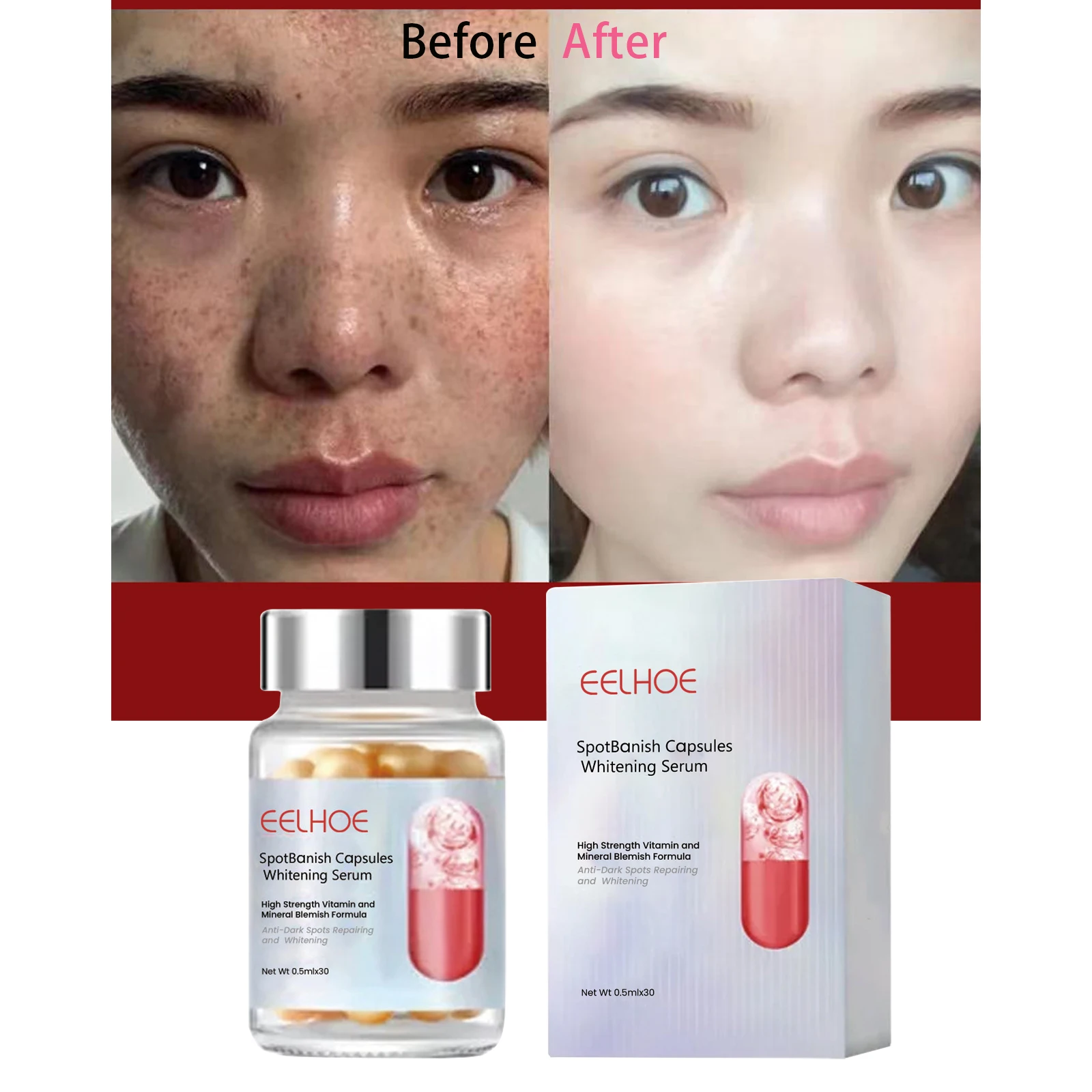 

Freckle Whitening Serum Brighten Remove Dark Spot Fade Pigment Melanin Correcting Pigmentation Moisturizing Korean Skin Care