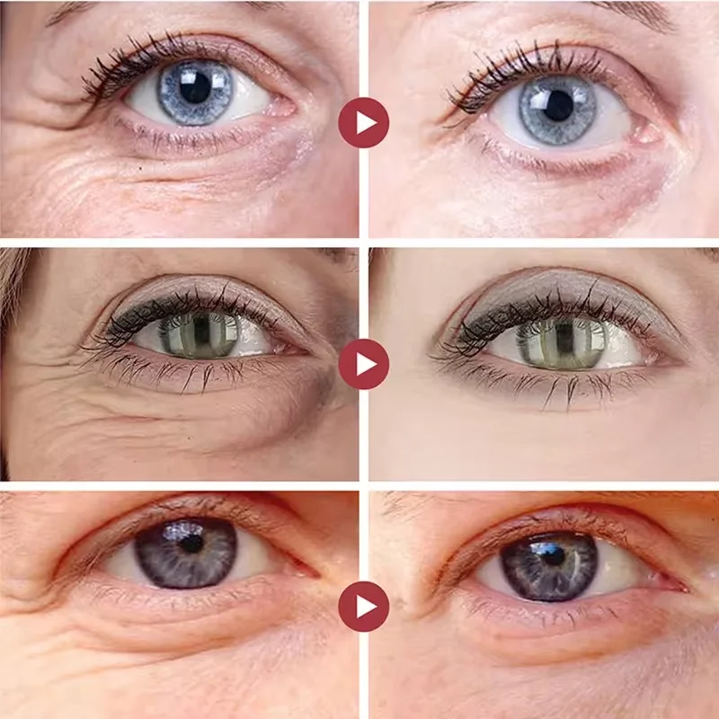 Collagen Eye Mask Anti-Wrinkle Eye Patches Fade Fine Line Remove Dark Circle Bag Anti-Puffiness Moisturizing Brighten Skin Care 2