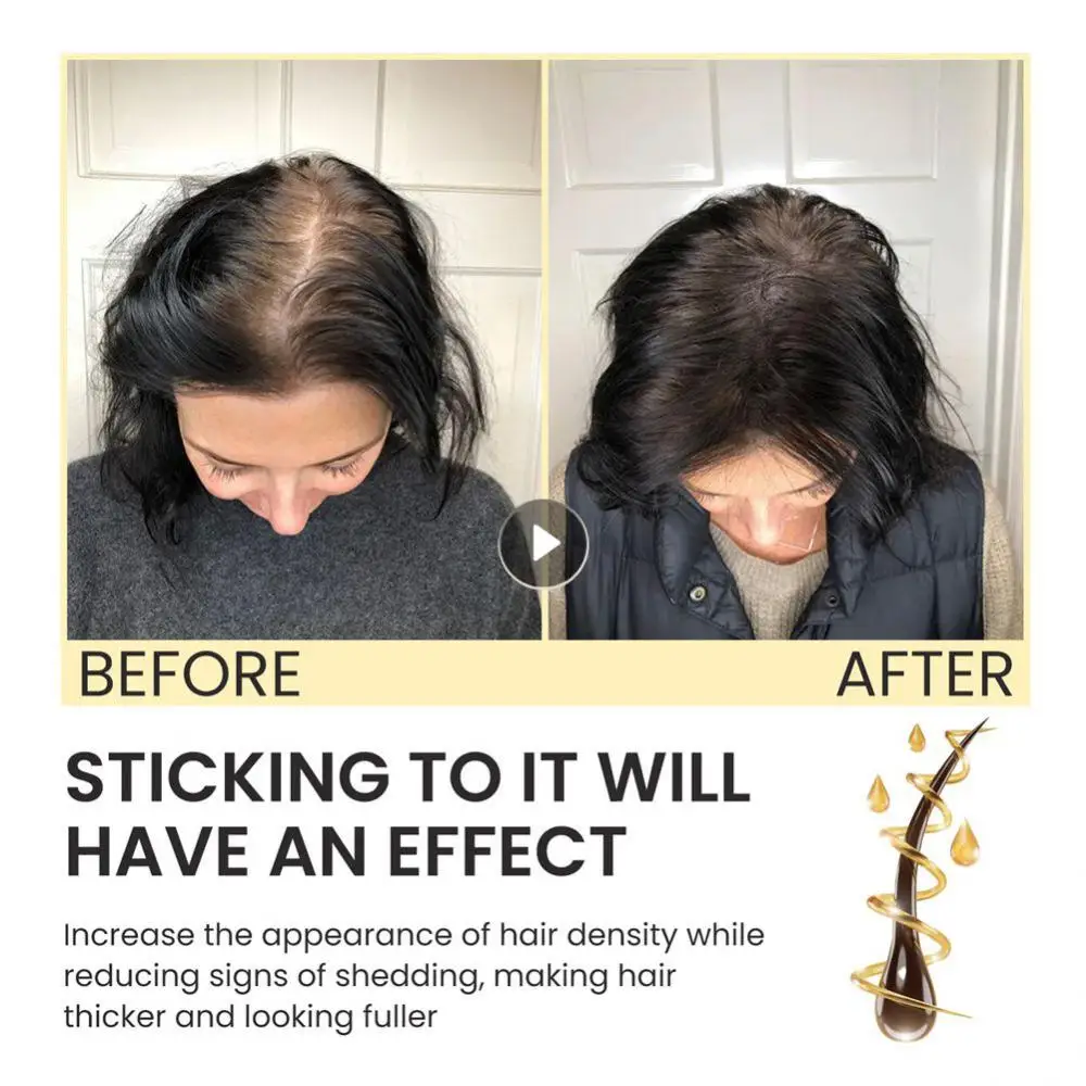 

Fixed Hair Reduce Bifurcations Personal Health Care Capacity 30ml Germinal Hair Moisturizing Hair Health Care Size 11.3 3 3cm