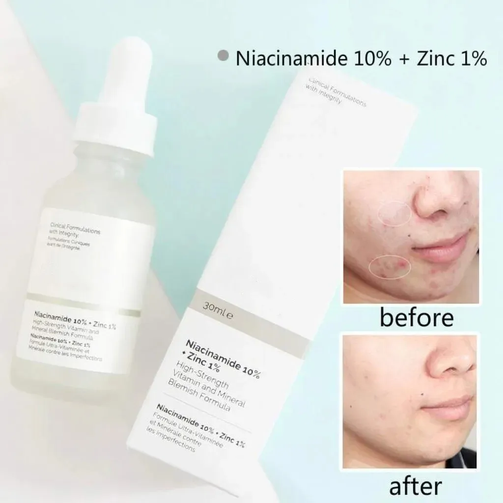 

Original Niacinamide 10% + Zinc 1% High Strength Vitamin And Mineral Blemish Formula Oil Control Whitening Moisturizing Serum