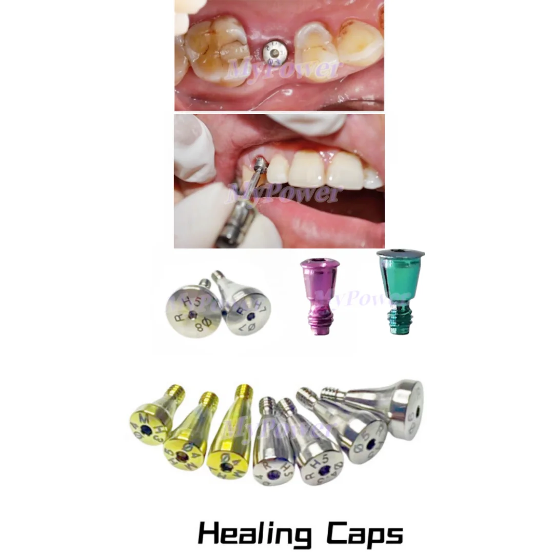 Tappi Curativi Dentali Per Impianti – Montanti Healing Cap Mini Piattaforma Regolare Per Osstem Hiossen