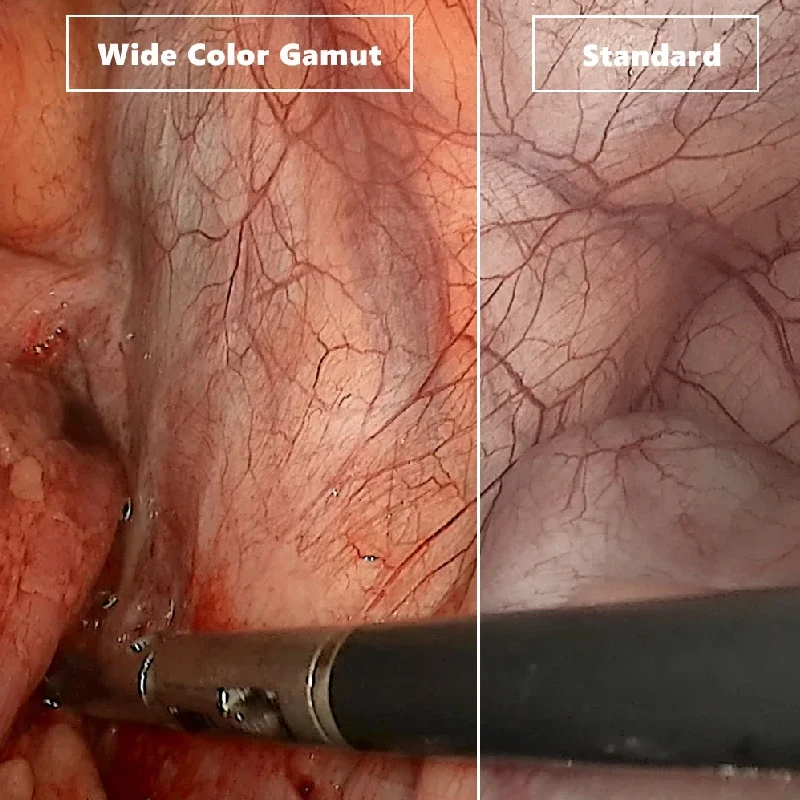 laryngoscope/ gastrointestinal/bronchus endoscopy with 360&deg; rotation, support for iOS Android Inclusive biopsy forceps