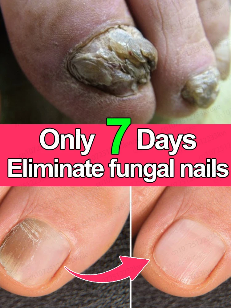 Organic Essential Oil Foot Serum 7-Day Repair