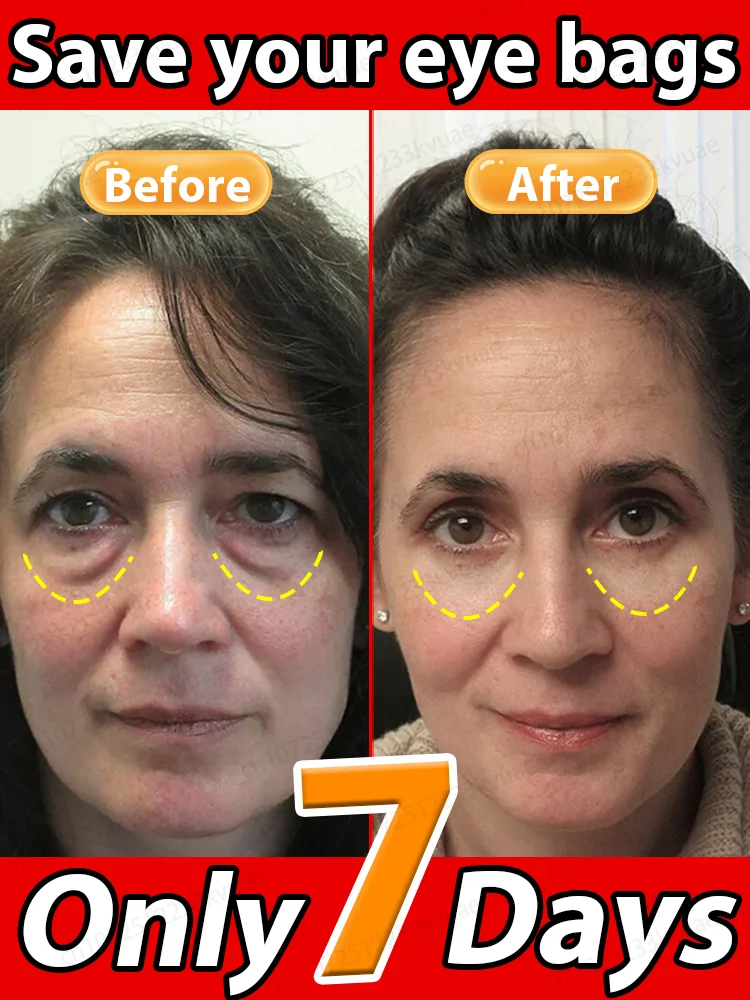 Eye Cream Keep your eyes forever young