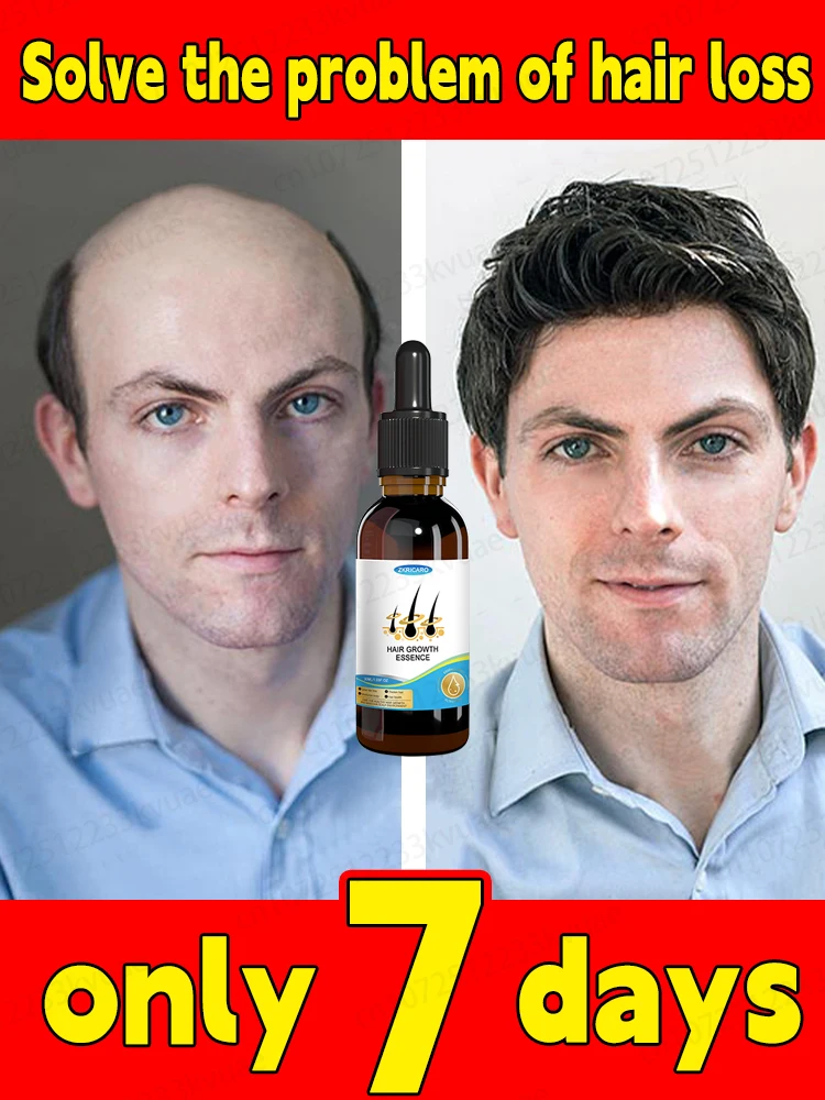 Essential oil for rapid hair growth that treats baldness and hair loss