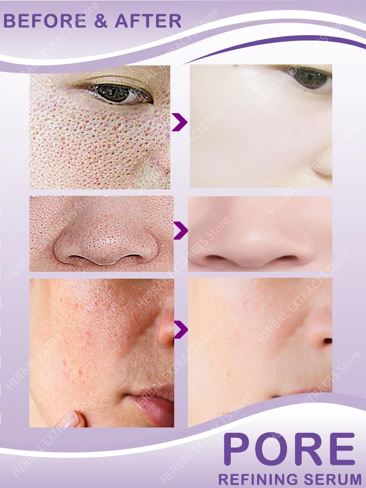 

Shrink pores repair facial skin and tighten pores