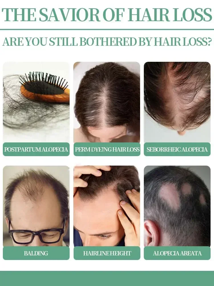 Hair Growth Oil Hair Growth Oil Fast Growing Hair Effective Essential Baldness Repair Hereditary Anti Postpartum Seborrheic Loss Products